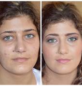 Before and after of makeup